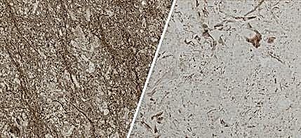 Limestone